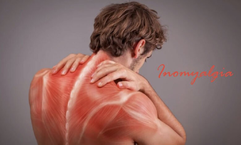 Inomyalgia