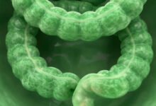 How Colonoscopy Brisbane Supports Screening Diagnosis and Ongoing Gut Health