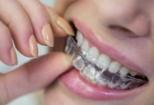 Clear Aligner Treatment Costs and What to Expect