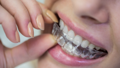 Clear Aligner Treatment Costs and What to Expect