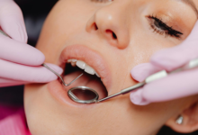 Restoring Smile Function After Major Tooth Loss or Damage Issues